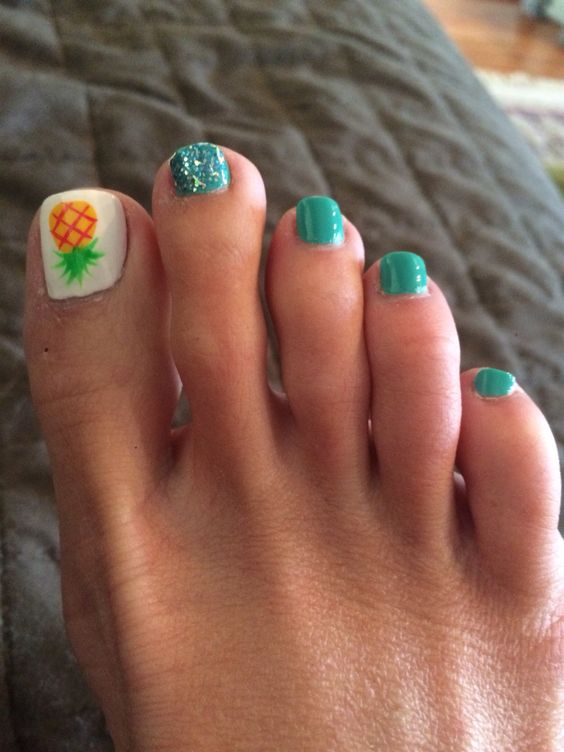 Pineapple pedicure with teal.