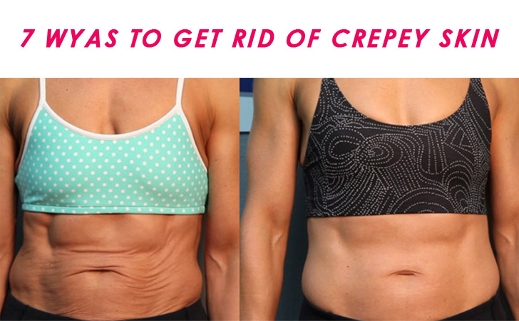 Get Rid of Crepey Skin