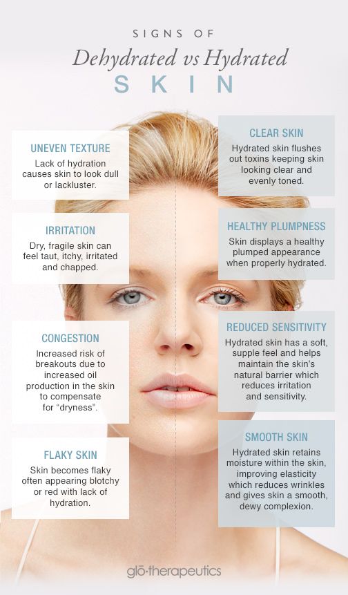 how to avoid dry skin