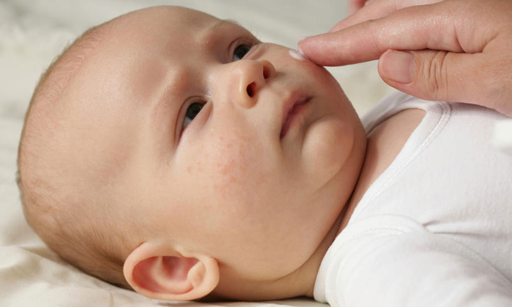 baby skin care Top 10 Dry Skin Care Tips for Babies