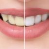 Whiten Your Teeth Naturally